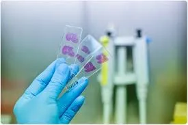 Análisis histopatológico en laboratorio de patología oral