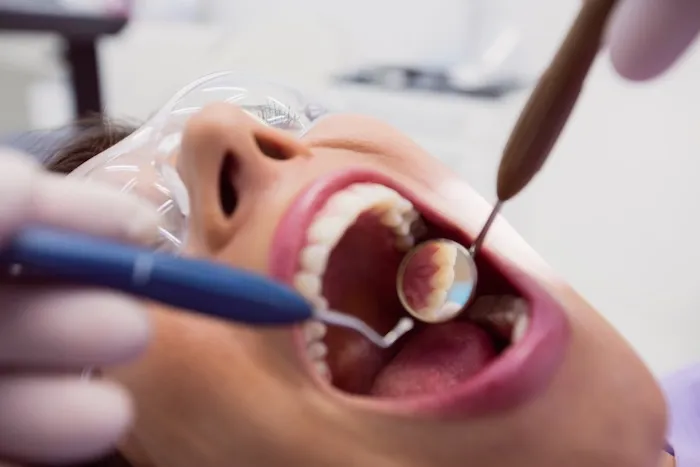 Detección de cáncer bucal en revisión dental